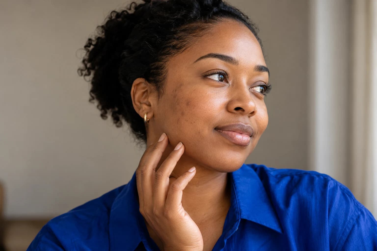 Woman in a blue shirt resting her fingertips along her jaw, with dark marks visible on her cheek.